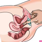 Squirting Orgasm: What It Is How It Feels Tips To Make It Happen