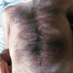 Naked Hairy Men 45 Years Old