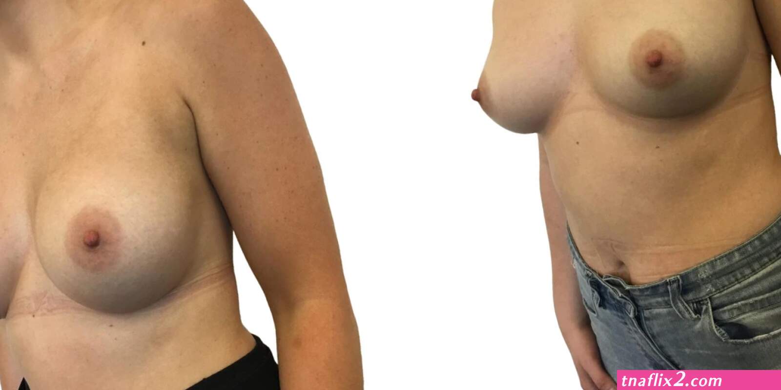 Perfectly round boobs