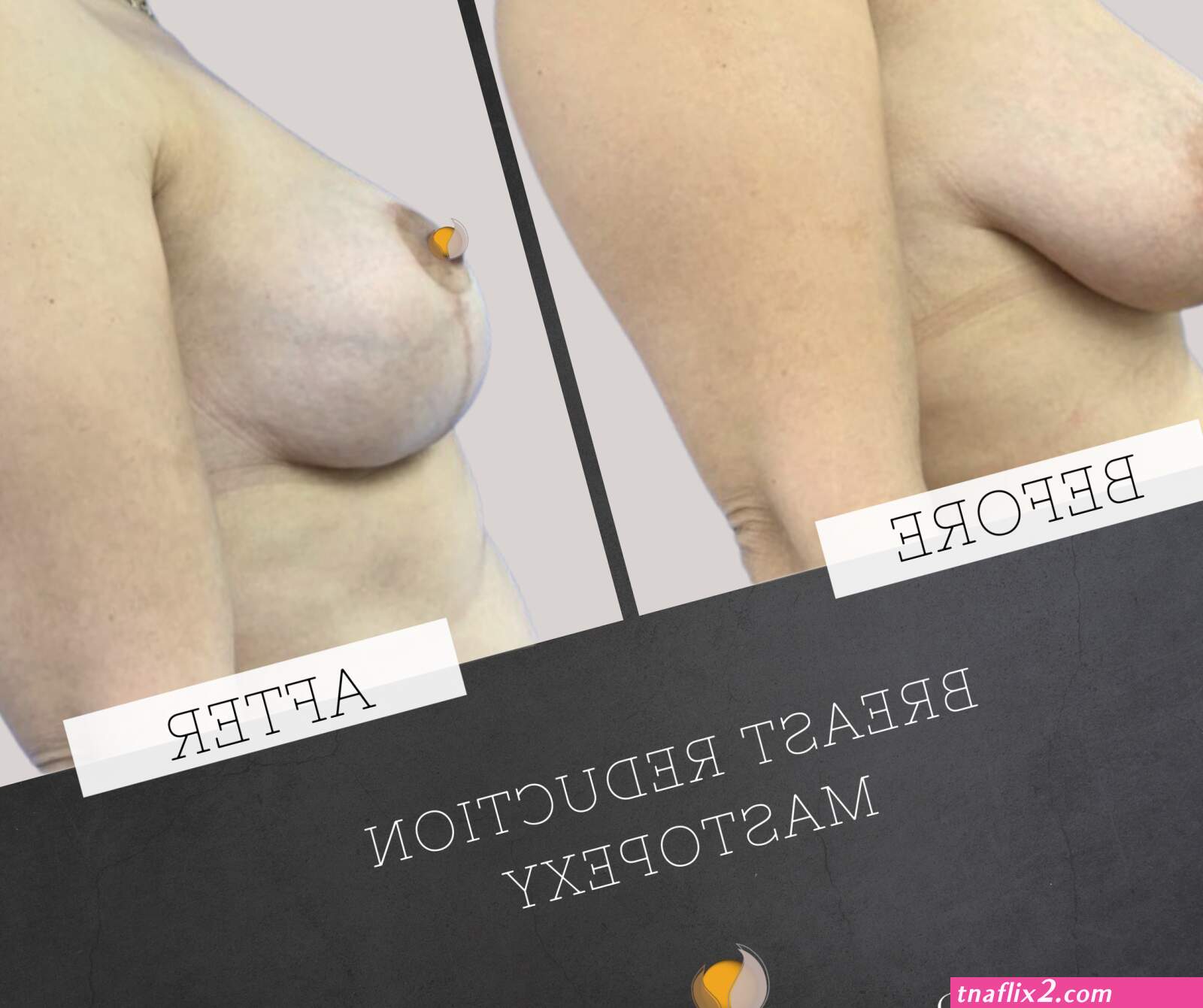 Boobs breast alero
