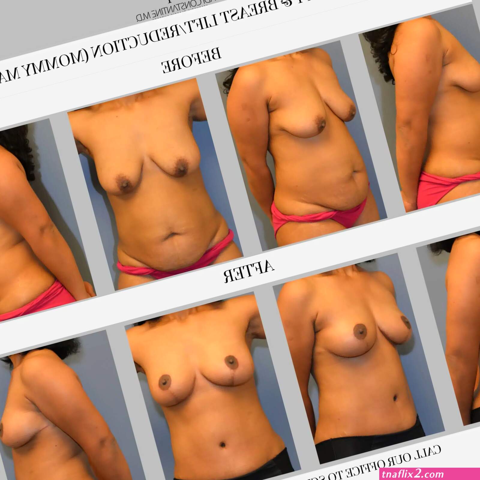 Lift boobs